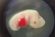 The Future of Organ Transplantation: Synthetic Organs and the Road to Ending the Donor Crisis