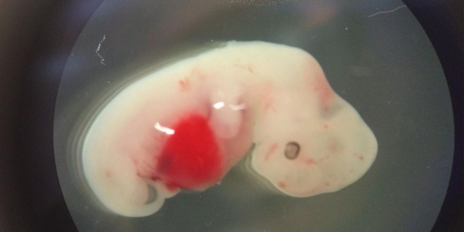 The Future of Organ Transplantation: Synthetic Organs and the Road to Ending the Donor Crisis